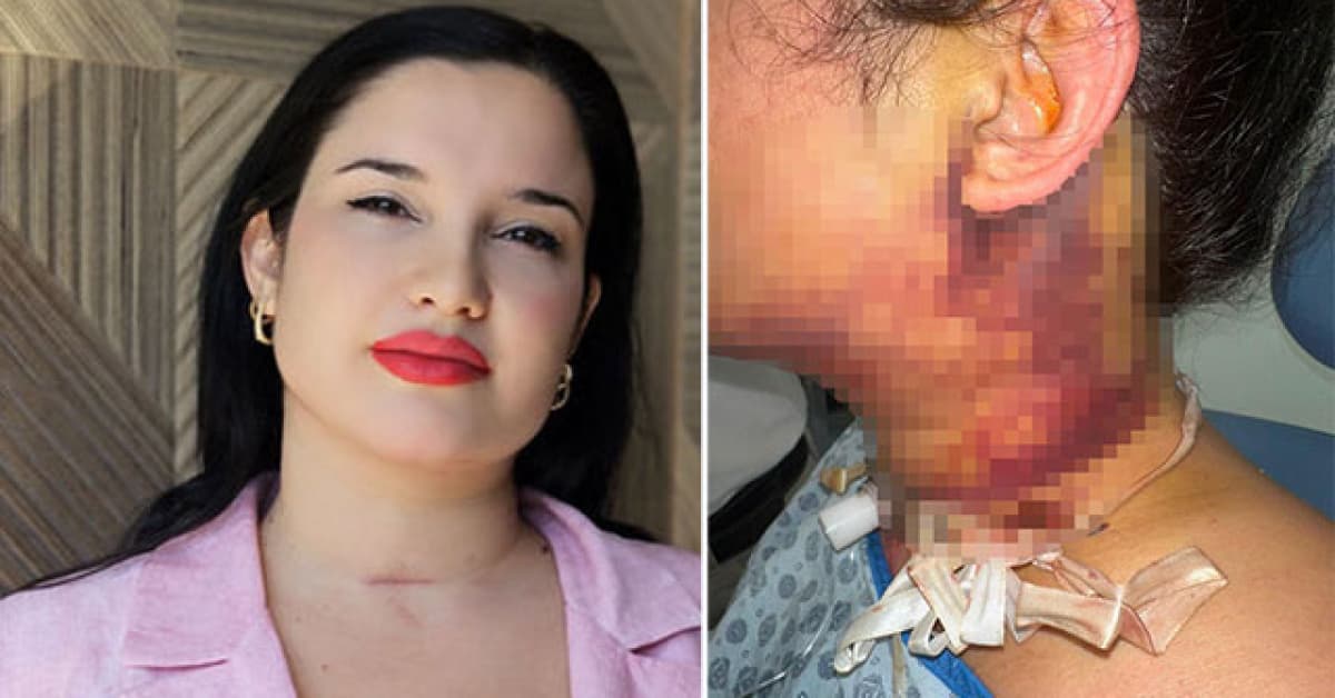 Estetik operasyonu kâbusla son buldu!
