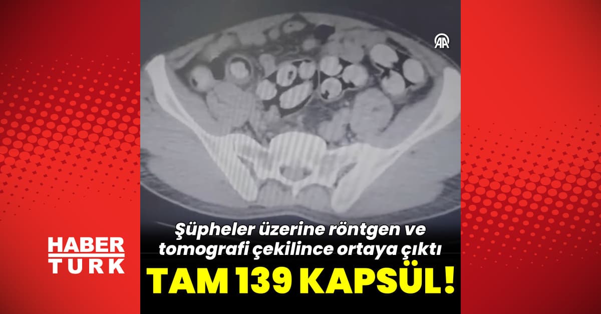 Tam 139 kapsül! Tomografide ortaya çıktı