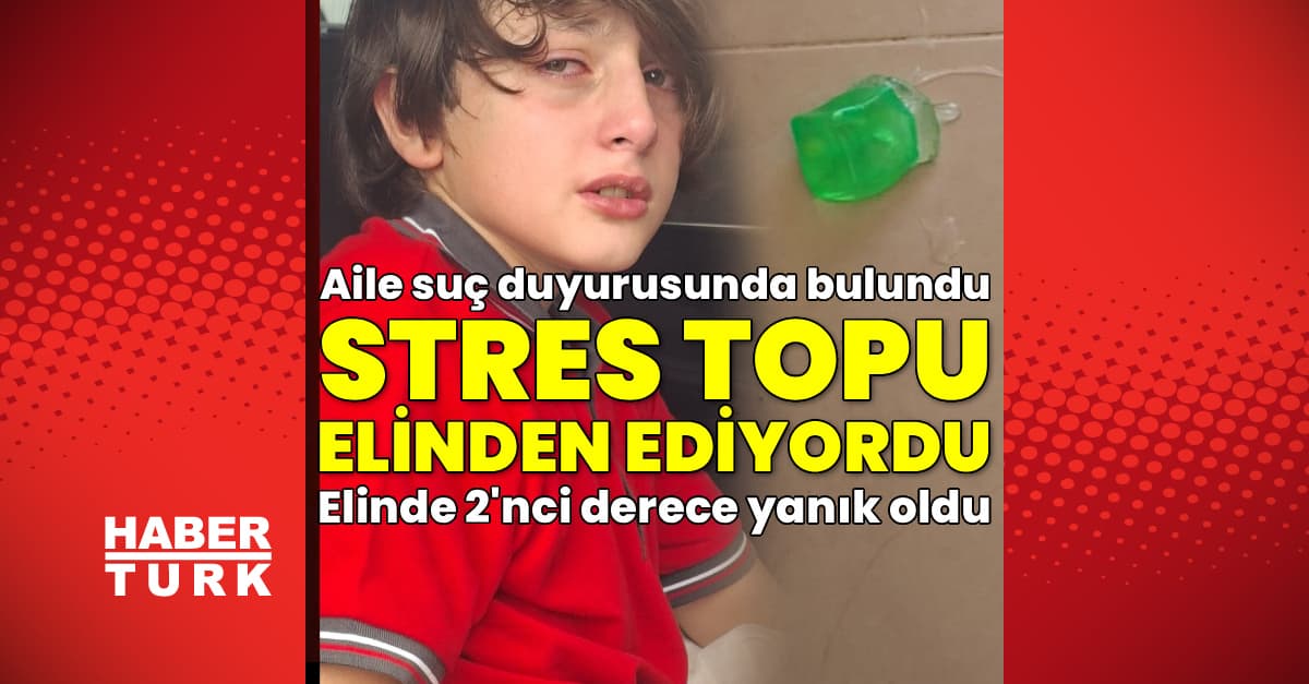 Stres oyuncağı elinde patladı! Yanık ve kızarık oldu