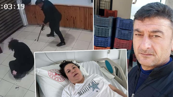 Boşanma aşamasındaki eşi tarafından vuruldu, bacakları ampute edildi! 'Pes' dedirten savunma: Sevdiğim için oldu