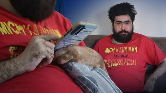 Hayat hikayesi ile Türkiye'nin dikkatini çeken Barış'ın son hali şaşırttı: 'En son ne zaman duş aldığımı hatırlamıyorum'
